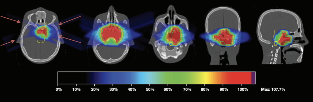 Proton therapy dosimetry head, scan